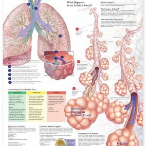 Chart 76 x 52 cm Laminated Asthma